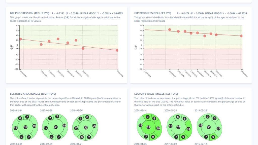 Grafik Advanced Glaucoma Tool von Retinalyze